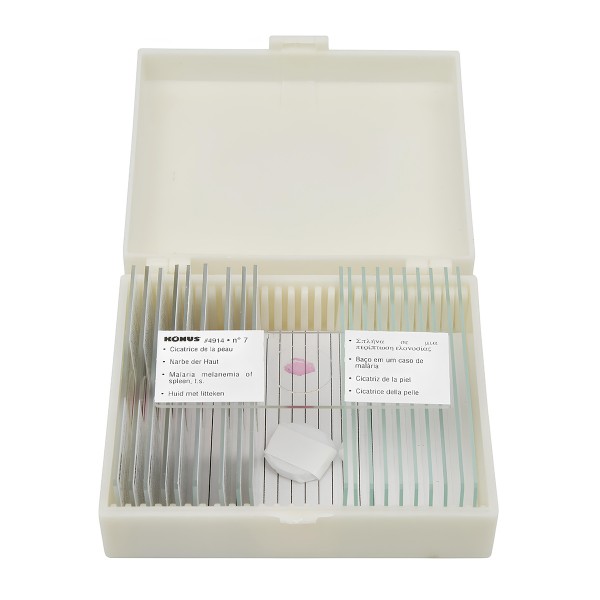 Набір мікропрепаратів KONUS Патологічні тканини людського тіла, частина I (10 шт.)