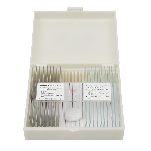 Набір мікропрепаратів KONUS Патологічні тканини людського тіла, частина II (10 шт.)